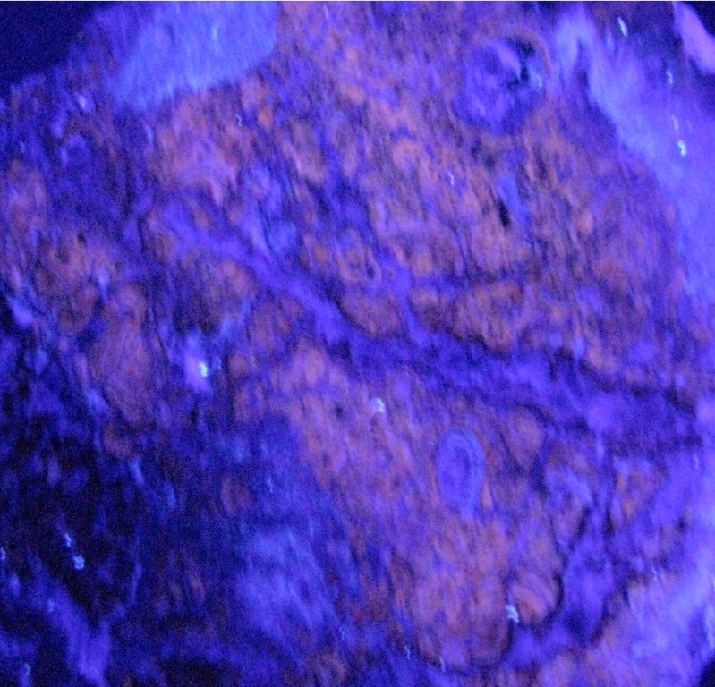 Schalenblende